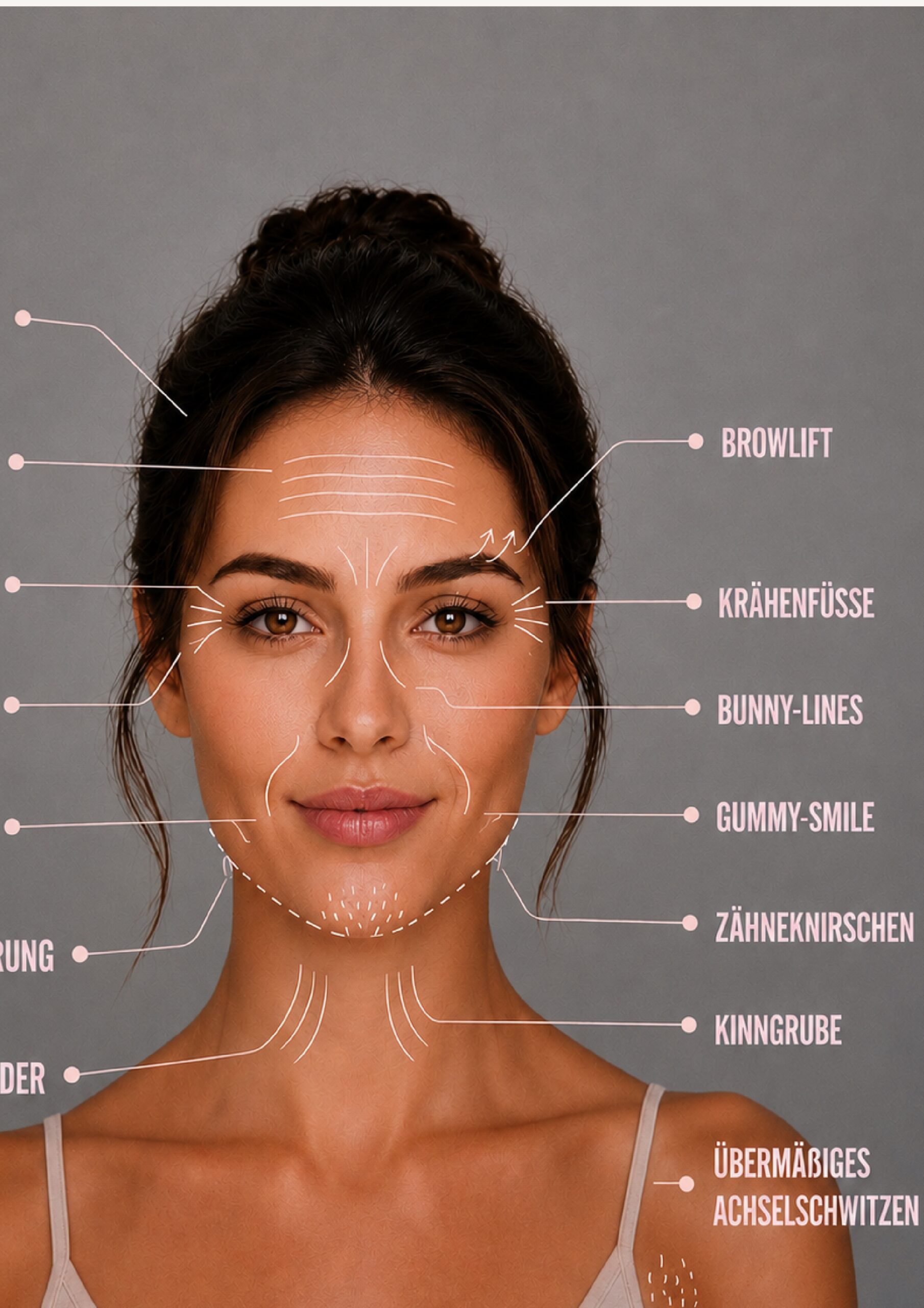 Botox Behandlungsbereiche